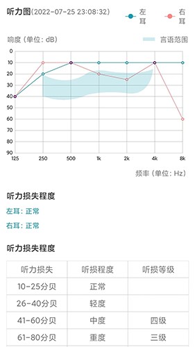 亿耳听力医生截图4